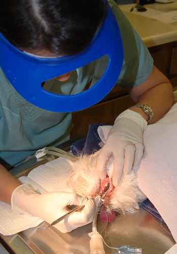 dental cleaning